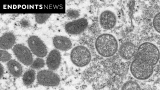 CDC, NIH, FDA leaders call for US-based clinical trial of smallpox drug in treating monkeypox – Endpoints News