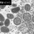 Texas has some of the most monkeypox cases in the US, data shows. Here’s where San Antonio ranks.