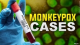 CDC reports at least 10 cases and counting of Monkeypox in Nebraska