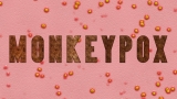 Monkeypox case numbers grow; Labcorp says it’s first national lab to offer a test