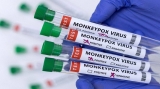 Europe to consider ways to increase monkeypox vaccine, WHO seeks trials
