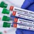 Medical experts urge caution as COVID case numbers rise in Boston