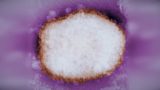 Monkeypox outbreaks in Canada and worldwide signal shift in virus behaviour
