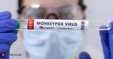 US expert, Health News, ET HealthWorld