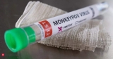 Monkeypox outbreak can be eliminated in Europe, WHO says, Health News, ET HealthWorld