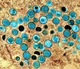 Monkeypox outbreak highlights need for preventative approach to prevent future zoonotic diseases