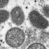 Symptoms Affect 1 in 5 After Acute Infection, CDC Study Finds – NBC New York