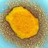 Half Coronavirus patients report long-term health issues