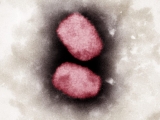 B.C. making monkeypox vaccine available to anyone in province