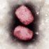 Parechovirus Sickened 23 Infants in Tennessee, C.D.C. Says