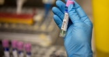 First case of monkeypox reported on Vancouver Island, bringing B.C. total to 21