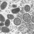 Monkeypox: WHO calls emergency meeting on Europe cases surge