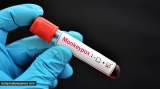 Italy kicks off vaccination campaign against monkeypox