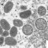 Monkeypox is not a side effect of the COVID-19 vaccine