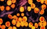 CDC: Black, Hispanic MSM most affected by monkeypox