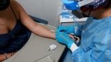 Mpox cases among women mostly affected Black, Hispanic Americans: CDC