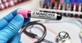 Can you be asymptomatic with monkeypox? Experts answer
