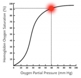 Administration of Supplemental Oxygen | NEJM
