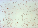 New CDC data reveals pandemic lockdowns did not slow the spread of gonorrhea and syphilis