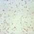 CDC, State Dept. of Health alter long used method of tracking COVID-19 cases