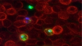 How young children’s immune systems respond to malaria vaccine