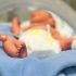 WHO considers declaring monkeypox a global health emergency