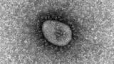 Japanese researcher suggests ties between omicron variant and severe hepatitis in children