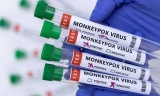 CDC: More Than 29K Monkeypox Cases Reported in US