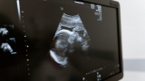 When moms get vaccinated during pregnancy, babies get protection too, study show : Shots