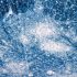 Root cause-targeting treatment may offer long-term relief
