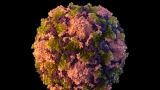 Polio virus detected in 2 Canadian wastewater samples