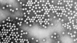 New York reports 1st U.S. polio case in close to a decade