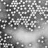 Polio case in New York is the first in the U.S. since 2013 : NPR