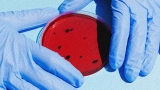 Salmonella outbreak: This CDC map shows where it's spreading – Fast Company