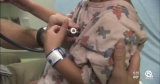 Loxahatchee doctor provides insight on hepatitis in young kids after CDC alert