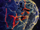 DR Congo investigates suspected Ebola case