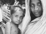 How Rahima came to hold a special place in smallpox history — and help ensure its end – NPR News