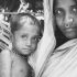 CDC warns doctors to watch for monkeypox