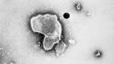 RSV cases hit 2-year high, CDC data shows