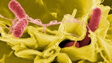 Mysterious Salmonella Outbreak Grows – NBC Chicago