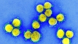 N.L. sees first case of new COVID-19 subvariant