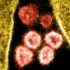 After Covid, risks of heart problems remain elevated for up to a year