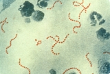 UKHSA update on scarlet fever and invasive group A strep