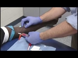 Sexually Transmitted Infections on the Rise, CDC reports – Cleveland Clinic Newsroom