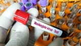 Monkeypox Cases Rise in U.S., Along With Concerns Of Stigmatizing Those Impacted – NBC Chicago