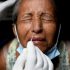 CDC issues health alert for severe hepatitis cases in children
