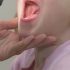 Viral mix of COVID, flu and RSV further pressures Mass. health workers