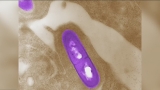 CDC looks at Florida as potential source for listeria outbreak