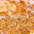 Long COVID Could Be An Autoimmune Disease