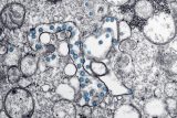 Chronic COVID-19 infections are source of variants of concern, study shows
